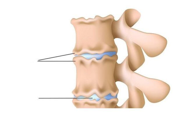 lesión de la médula espinal