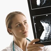El diagnóstico de osteocondrosis se determina utilizando un examen x -ray