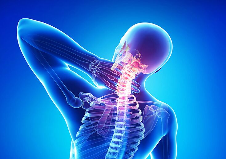 La osteocondrosis de la columna es una enfermedad que afecta el cartílago articular y las vértebras.